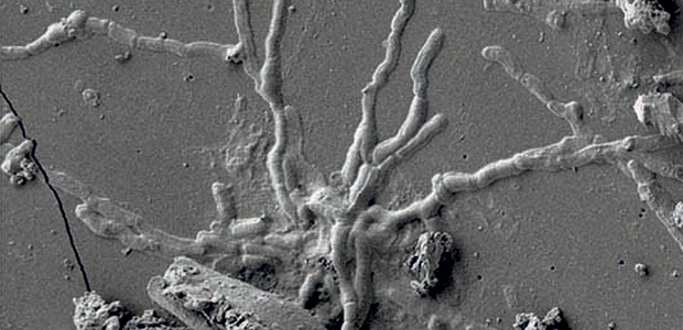 Immagine relativa al contenuto Neuroni nel cervello vetrificato di una vittima dell'eruzione del 79 d.C.