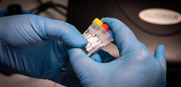 Immagine relativa al contenuto Supporto alla diagnosi di malattie rare tramite IA