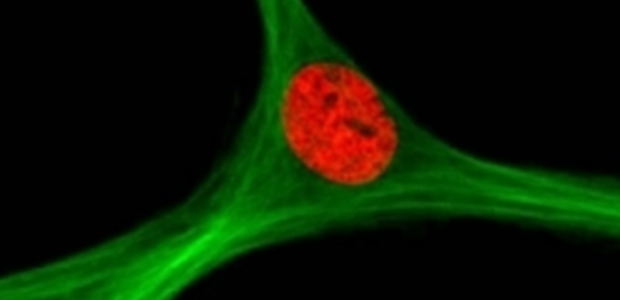 Immagine relativa al contenuto Controllare le funzioni immunoregolatorie delle cellule staminali mesenchimali