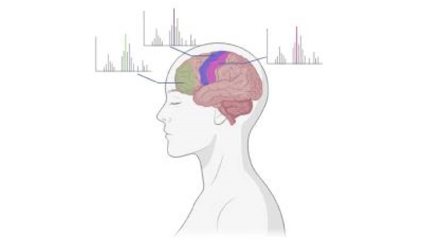 cervello disegnato con aree di colore diverse